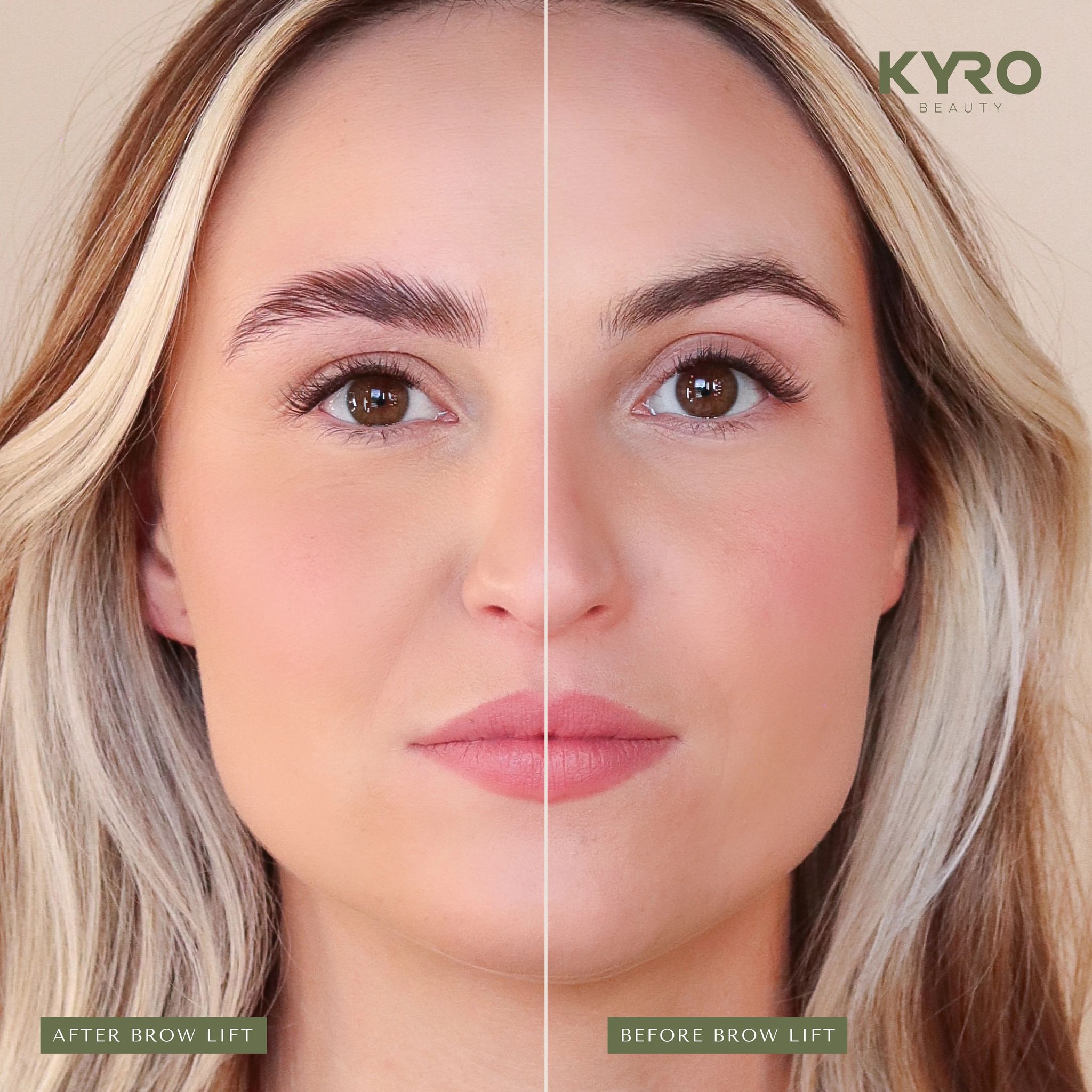Expert Guide to Safe Wimperlifting at Home for Lashes Expert Guide to Safe Wimperlifting at Home for Lashes